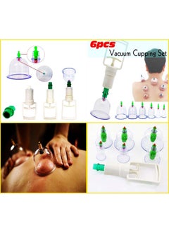 Chhogli Chhogli Vacuum Cupping Set 6 PCS Kit Pull Out a Vacuum Apparatus Therapy Relax Massagers Curve Suction PumpsWhite  - Image 2