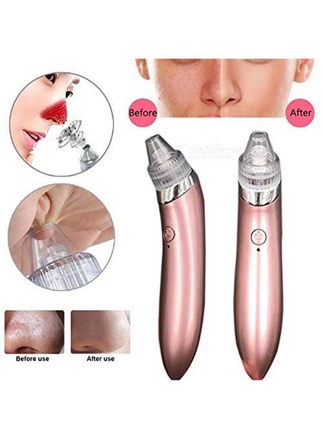 RK enterprise Cleaner Vacuum Beauty Facial Skin Care Blackhead Remover (Rose Red) - Image 3