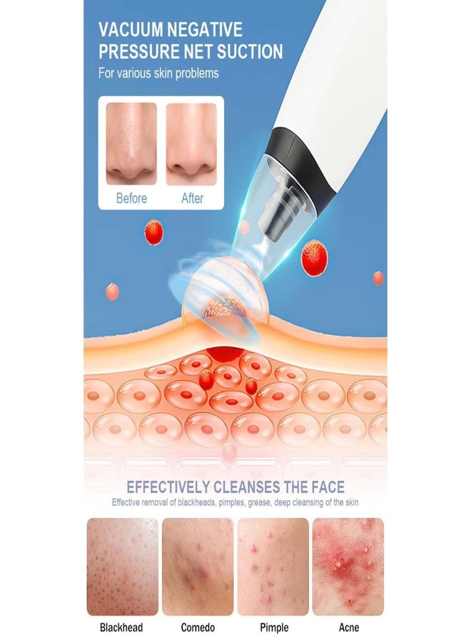 SKYLIGHT Blackhead Remover Vacuum Electric Pore Cleaner for Whitehead Removal Tool, Acne Deep Face Machine, USB Rechargeable Derma Adjustable Suction & Interchangeable Heads Facial Device Men Women - Image 5
