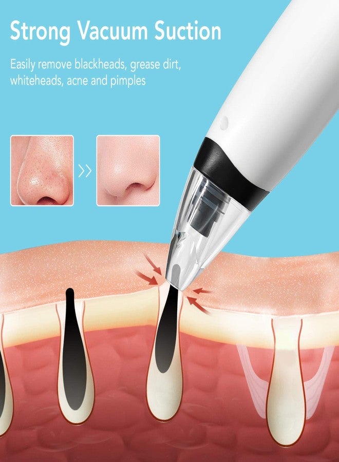 SKYLIGHT Blackhead Remover Vacuum Electric Pore Cleaner for Whitehead Removal Tool, Acne Deep Face Machine, USB Rechargeable Derma Adjustable Suction & Interchangeable Heads Facial Device Men Women - Image 3