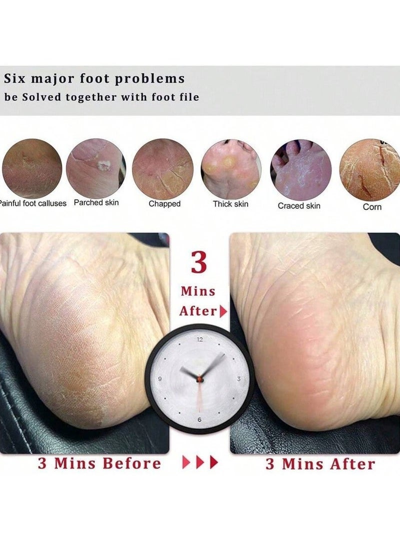 2-Piece Foot Scrubber Pedicure Foot File Pumice Stone,Professional Pedicure Supplies Callus Remove Cracked Heels,Dead Skin,Corn,Scraper File Foot Care Foot Rasp Massage Brush Tools Kit for Men/Women - Image 5