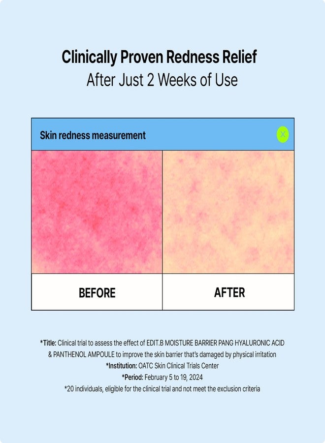 EDIT.B Moisture Barrier Pang Hyaluronic Acid Panthenol Ampoule, Long-Lasting Deep Hydration Lightweight Facial Moisturizing Serum, Soothing and Hydrating, Korean Daily Skin Care, 3.38 fl.oz (100ml) - Image 5