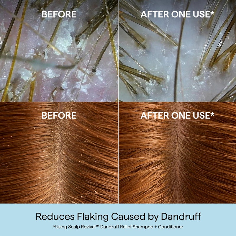 Briogeo Scalp Revival™ Charcoal + 3% Salicylic Acid  Dandruff Relief Shampoo - Image 3