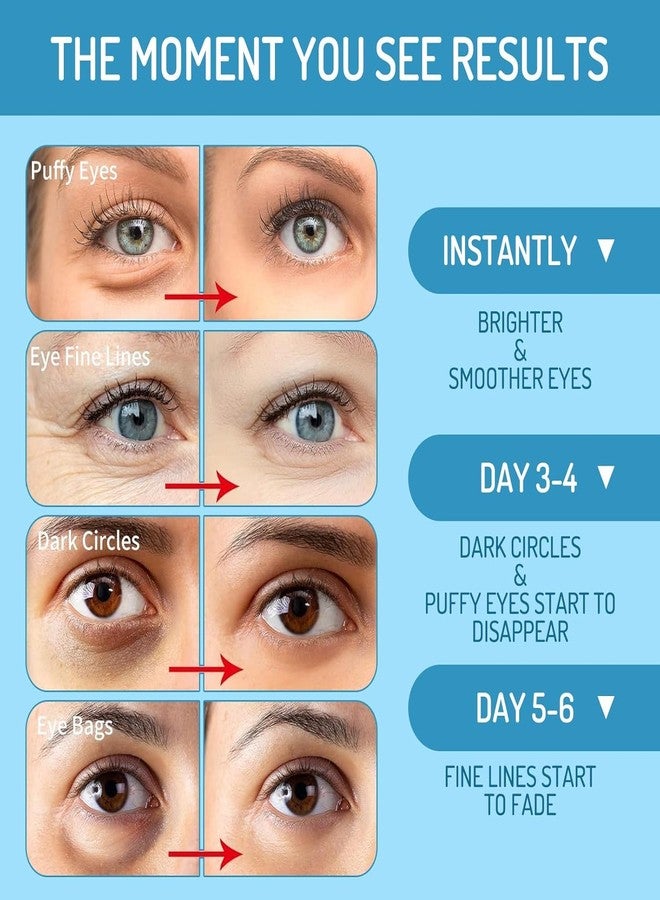 AOAO Revitalizing Under Eye Patches, 30 Pairs Brightening & Smoothing Eye Gels with Retinol, Collagen, Hyaluronic Acid, Hydrating Cooling Anti Aging Under Eye Masks for Dark Circles, Puffiness & Fine Lines - Image 3