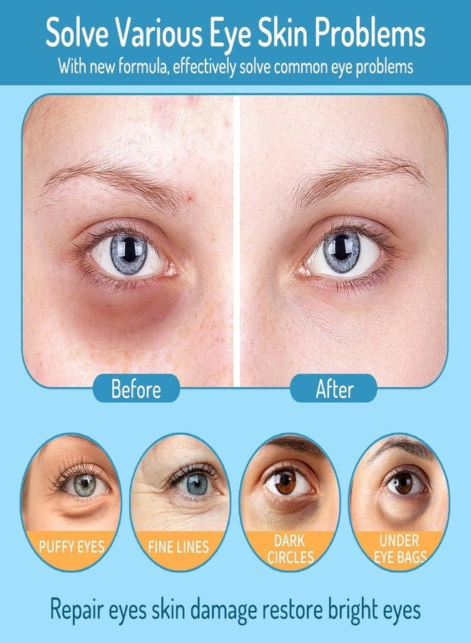 AOAO Revitalizing Under Eye Patches, 30 Pairs Brightening & Smoothing Eye Gels with Retinol, Collagen, Hyaluronic Acid, Hydrating Cooling Anti Aging Under Eye Masks for Dark Circles, Puffiness & Fine Lines - Image 2