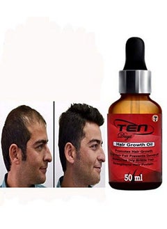 7 Days Ten Days Onion Hair Growth Oil For Promote Hair Growth | Stop Hair Fall Prevents Dandruff | Moisturizer Dry Brittle Hair | Strengthens Hair Proteins 50 Ml (100 Ml)  - Image 5