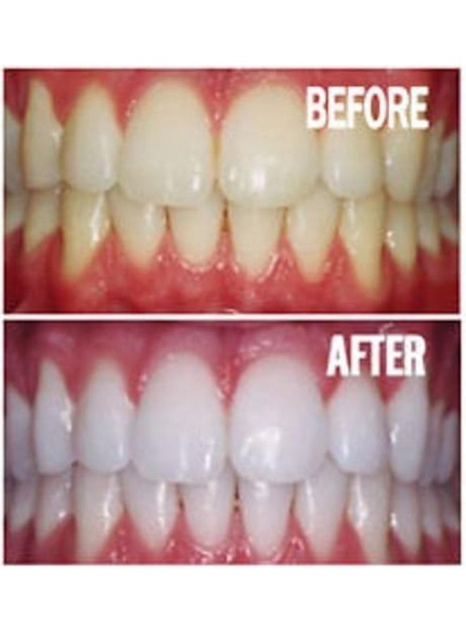 Bright White Smiles - Teeth Whitening Gel Refill Kit - 10 Tubes 44% Carbamide Peroxide Tooth Whitener Formula - Image 4