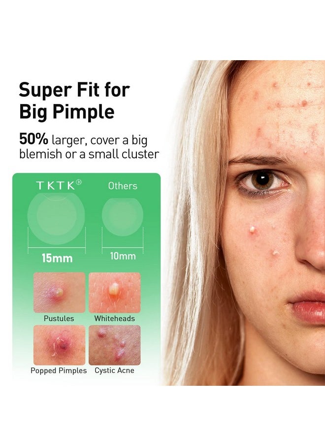 TKTK - Ktk Pimple Patches 15Mm Large Invisible Acne Patch For Face With Salicylic Acid 0.01Cm Extra Thin Daytime Use Hydrocolloid Zit Patch For Big Pustule Whitehead Cystic Acne Spot Treatment 48 Count - Image 1
