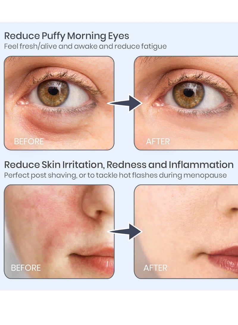 general Ice Roller for Face,Ice Globes for Facials by,360 Rotating Unbreakable Steel Ice Globes with Carry Case,Professional Esthetician Supplies,Ice Roller for Face and Eyes,Ideal Skincare Tool,White - Image 5