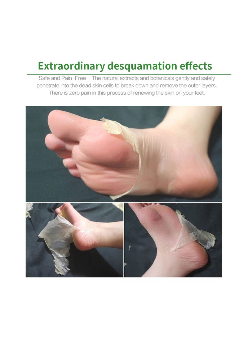 Generic - Aloe Vera Foot Peel Mask - Exfoliating Foot Peel Socks for Hard Skin Removal, Callus Remover, and Foot Care for Men and Women (3 Pcs) - Natural Aloe Vera Gel Formula. - Image 1