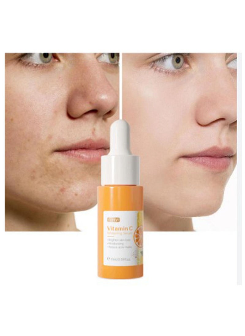 Fenyi - Vitamin C Serum for skin whitening 17 ml - Image 1