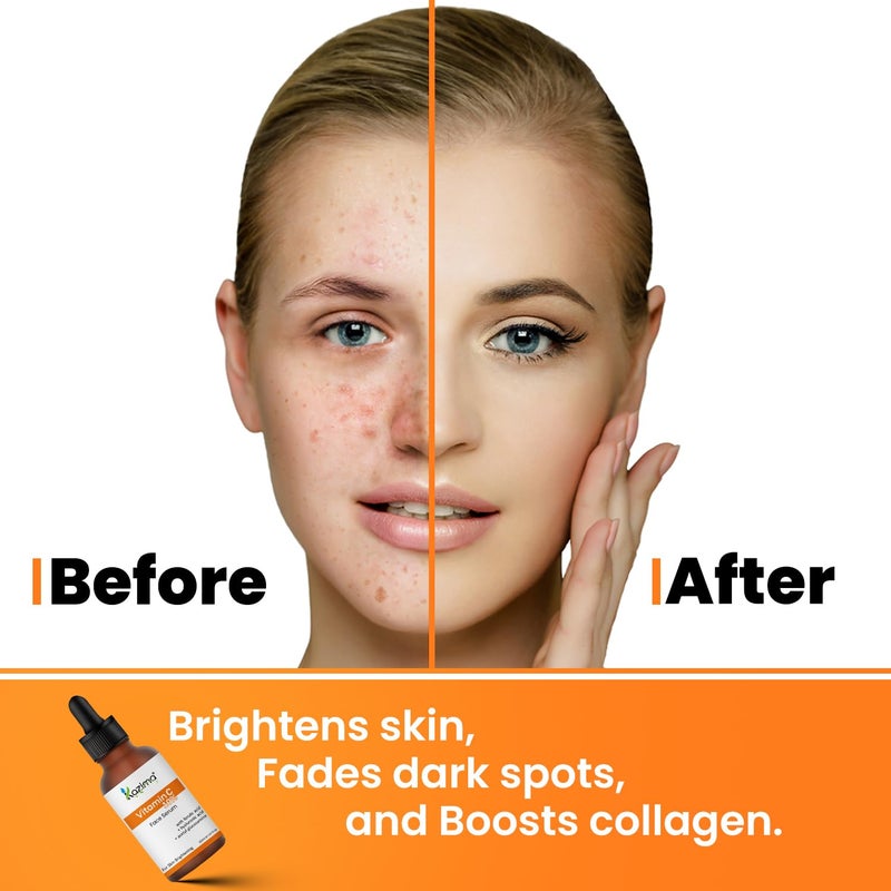 KAZIMA 10 Vitamin C Face Serum for Glowing Skin with 05 Ferulic Acid Targets Dark Spot Hyperpigmentation For Dull Skin Vitamin C Serum for Oily Skin Suitable for Men Women 30 ml - Image 5
