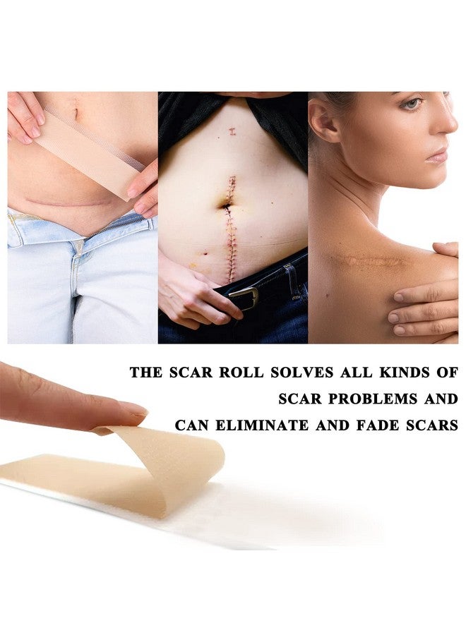 ZODENIS Medical Grade Silicone Scar Sheets, Silicone Scar Tape (1.6”X 60”), Scar Removal Strips For Acne Scars C-Section & Keloid Surgery Scars Sheets Treatment Sheets - 6-8 Month Supply - Image 4