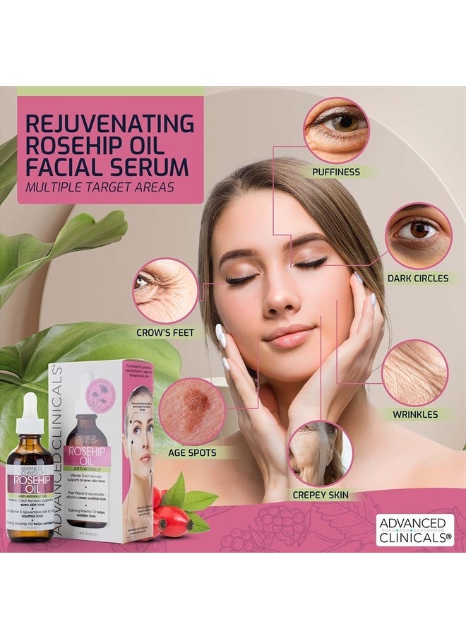 Advanced Clinicals Rosehip Oil Facial Skin Care Serum Moisturizer Face Oil W/Vitamin C & Vitamin E For Reducing Appearance Of Sun Damage Skin, Age Spots, & Wrinkles, 1.8 Fl Oz (Pack of 2)  - Image 5