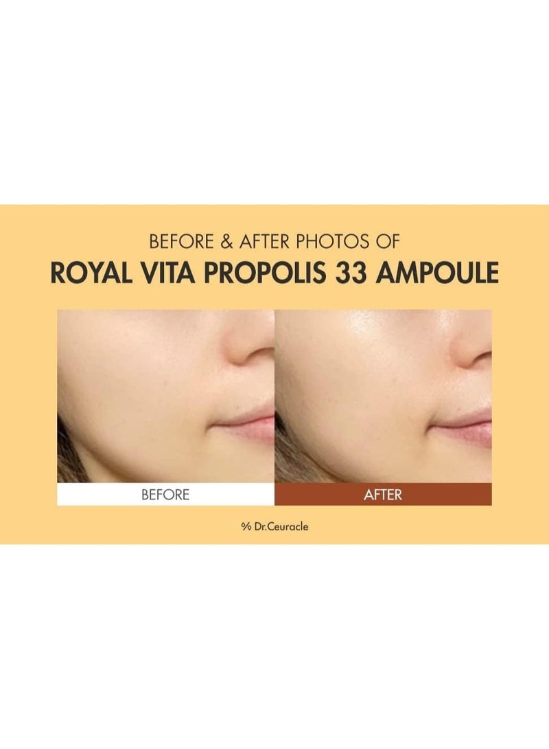 Dr. Ceuracle Dr.Ceuracle Honey Nourishing EssenceㅣRoyal Vita Propolis 33 AmpouleㅣKorean Skin Care Contains Royal Jelly Extract, PanthenolㅣEffective Vitamin Serum strengthen the skin Moisturizing, Soothing - Image 2