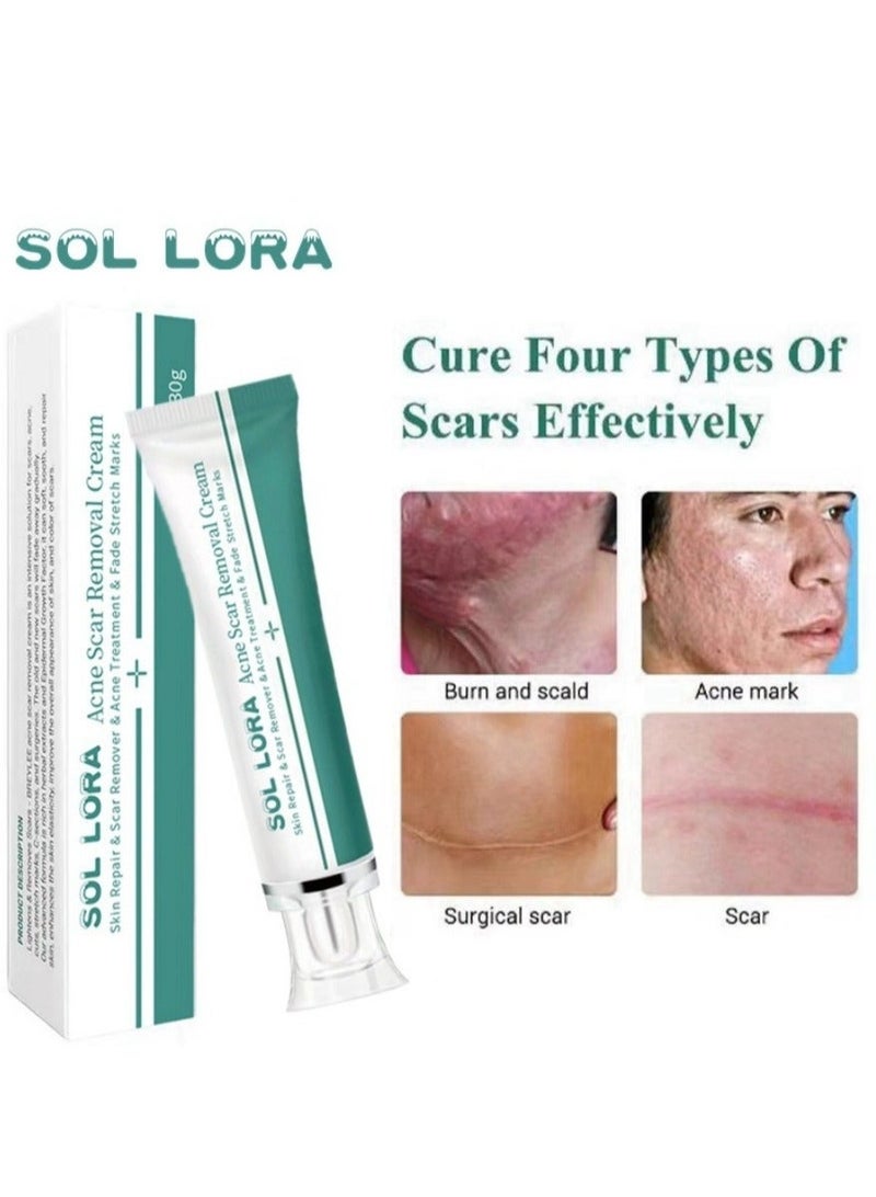 SOL LORA Acne Scar Removal Cream，Scar Erase ，Scar Removal Gel，Acne Scar Treatment，Deep Acne Scar Removal， Burns Keloids Hypertrophic， Repair Damaged Skin，Removing Acne Marks Scar Repair Cream ﻿ - Image 1