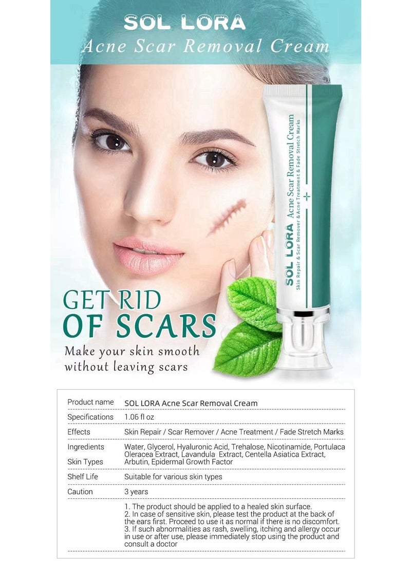 SOL LORA Acne Scar Removal Cream，Scar Erase ，Scar Removal Gel，Acne Scar Treatment，Deep Acne Scar Removal， Burns Keloids Hypertrophic， Repair Damaged Skin，Removing Acne Marks Scar Repair Cream ﻿ - Image 5