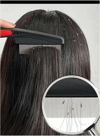 Lice Combs, Stainless Steel Fine Tooth Comb Lice Comb Professional Head Lice Nit Removal Hair Comb for Kids Adults Pets Dog Long/Short Hair - view 5
