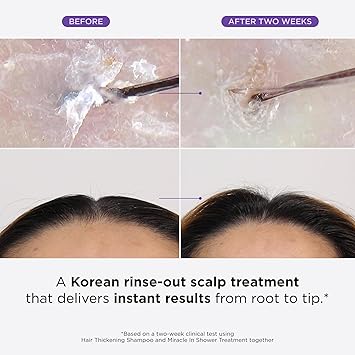 Dr.Groot Dr Groot Miracle in Shower Treatment for Hair Loss Korean Hair Care 5 Seconds to Smooth Hair Rosemary Oil for HealthierLooking Hair Hair Rinse Moisturizing TreatmentScalp Revitalizing Solution - Image 2