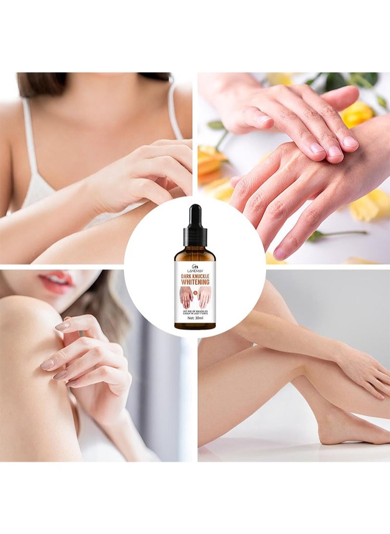 LANEMAY - Knuckle Dark Spot Corrector Serum, Lightweight Body Oil, Whitening Serum, Hyperpigmentation, Dark Spot Remover for Hands, Feet and Body, Skin Lightening Darkness Body Oil - Image 1