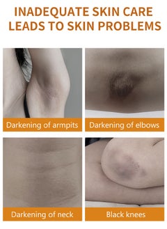 MOOYAM Underarm Dark Spot Corrector Cream, Dark Spot Remover For Underarm Neck Armpit Knees Elbows Private Areas Brighten And Moisturizes Body Instant Result 60ML  - Image 4