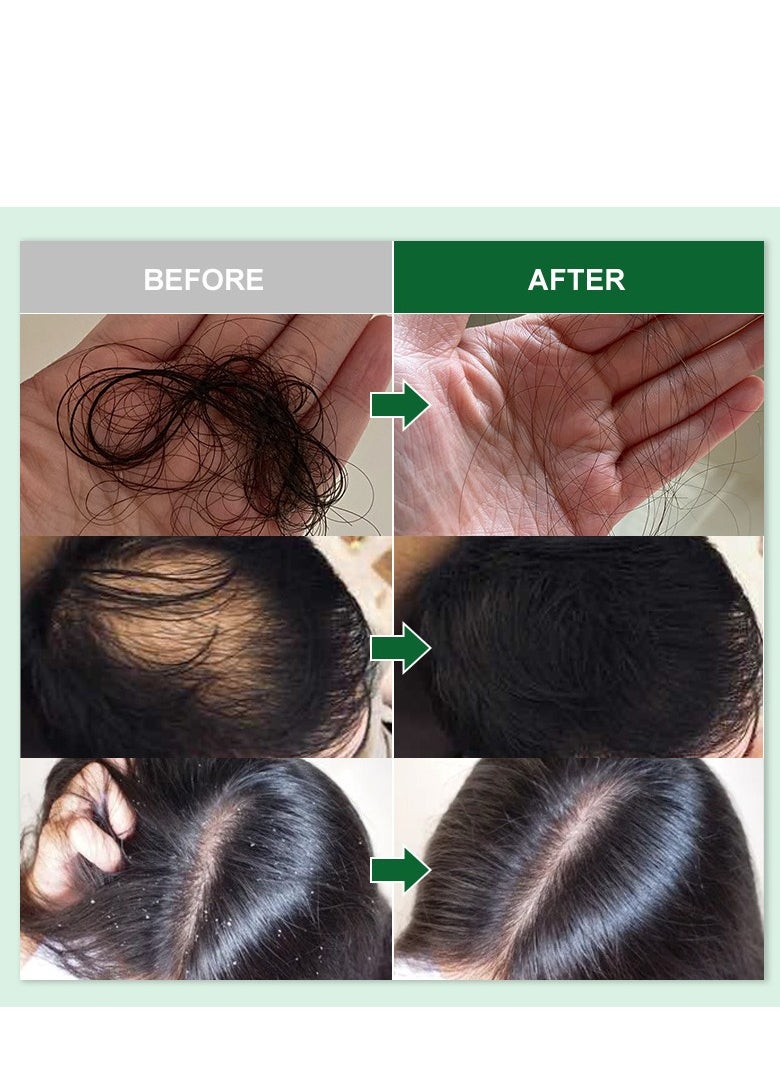 PURC Rosemary Hair Growth Oil, Nourishing Scalp Serum, Strengthening Treatment for Dry, Itchy Scalp, Promotes Thicker Hair for Men and Women (50ml) - Image 4