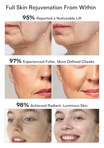 INIA 3-in-1 Red Light Therapy for Face and Neck Beauty Device for Puffiness & Skin Firming Skincare Tool (White) - Image 4