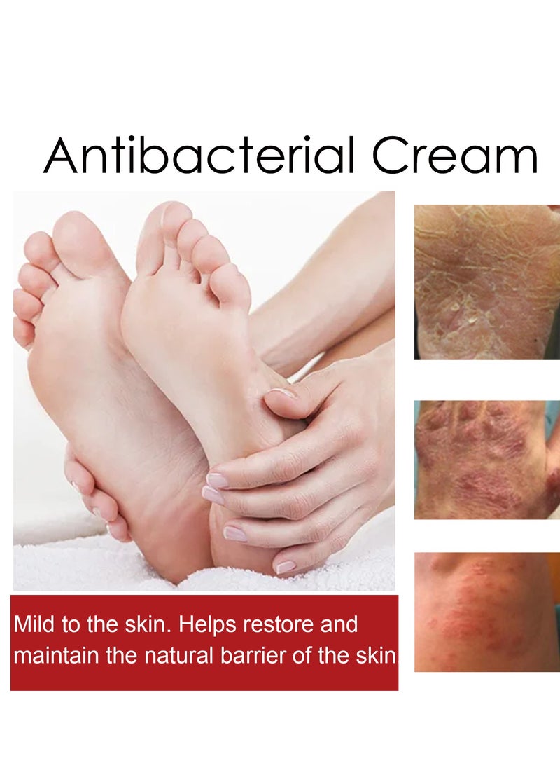 SOUTH MOON - Eczema and Psoriasis Atomizing Creams ，Natural Chinese Herbal Eczema Psoriasis Creams，Treatment Psoriasis Eczema Cream ，Antibacterial Antipruritic Dermatitis Herbal Ointment，Anti-itch Medical Plaster - Image 1