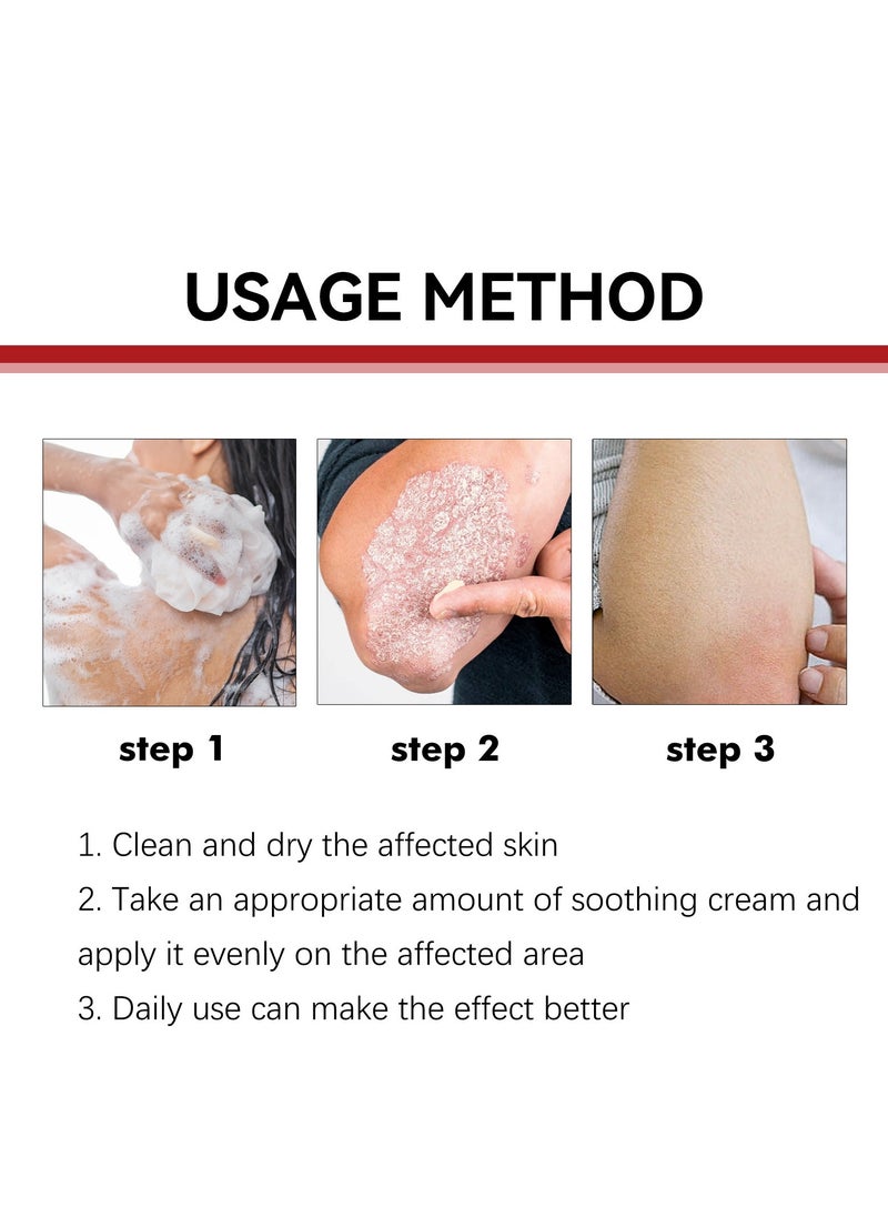 SOUTH MOON - Eczema and Psoriasis Atomizing Creams ，Natural Chinese Herbal Eczema Psoriasis Creams，Treatment Psoriasis Eczema Cream ，Antibacterial Antipruritic Dermatitis Herbal Ointment，Anti-itch Medical Plaster - Image 1