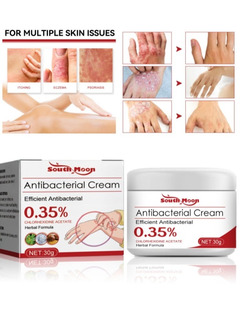 SOUTH MOON - Eczema and Psoriasis Atomizing Creams ，Natural Chinese Herbal Eczema Psoriasis Creams，Treatment Psoriasis Eczema Cream ，Antibacterial Antipruritic Dermatitis Herbal Ointment，Anti-itch Medical Plaster - Image 1