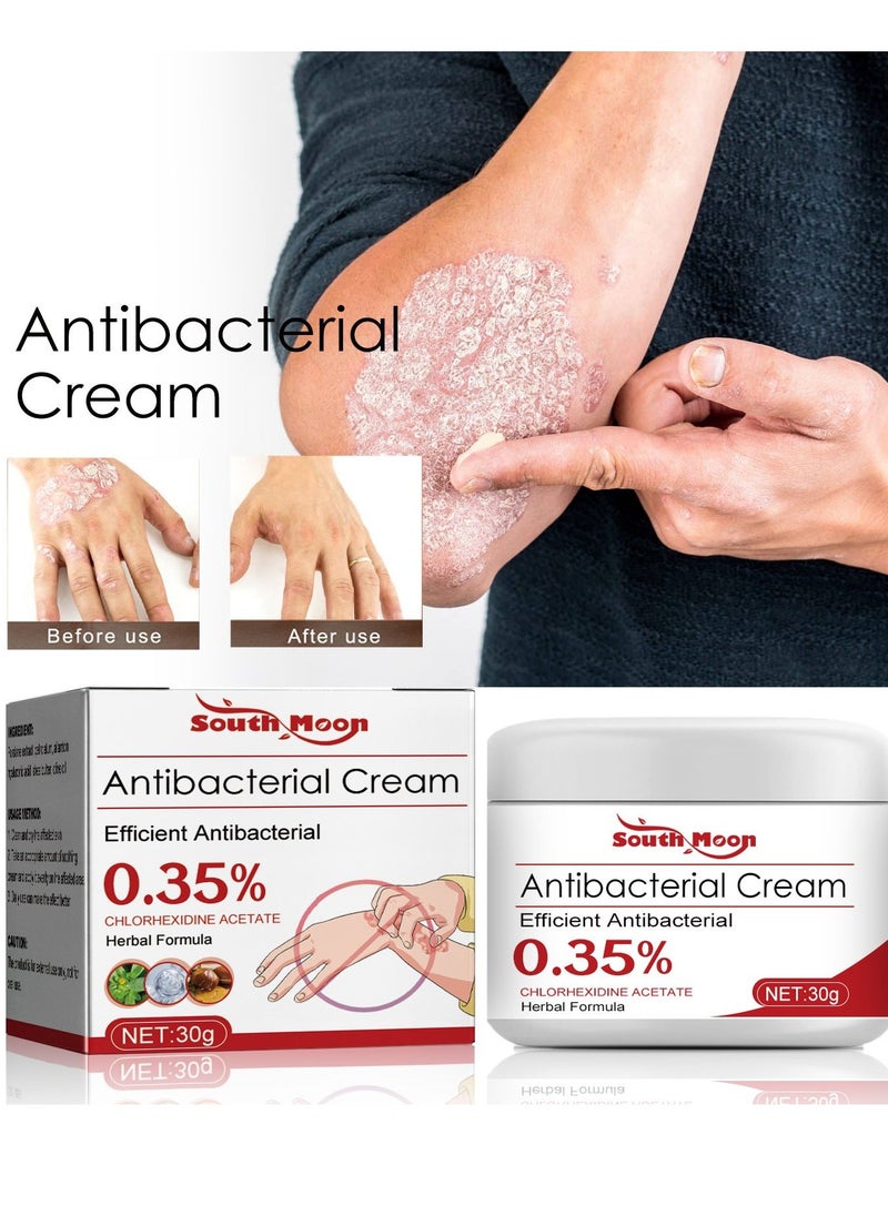 SOUTH MOON - Eczema and Psoriasis Atomizing Creams ，Natural Chinese Herbal Eczema Psoriasis Creams，Treatment Psoriasis Eczema Cream ，Antibacterial Antipruritic Dermatitis Herbal Ointment，Anti-itch Medical Plaster - Image 1