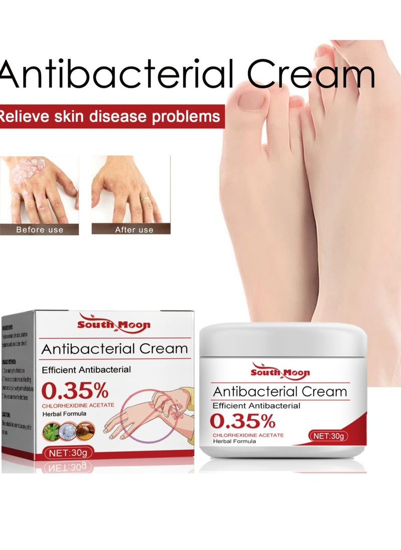 SOUTH MOON - Eczema and Psoriasis Atomizing Creams ，Natural Chinese Herbal Eczema Psoriasis Creams，Treatment Psoriasis Eczema Cream ，Antibacterial Antipruritic Dermatitis Herbal Ointment，Anti-itch Medical Plaster - Image 1
