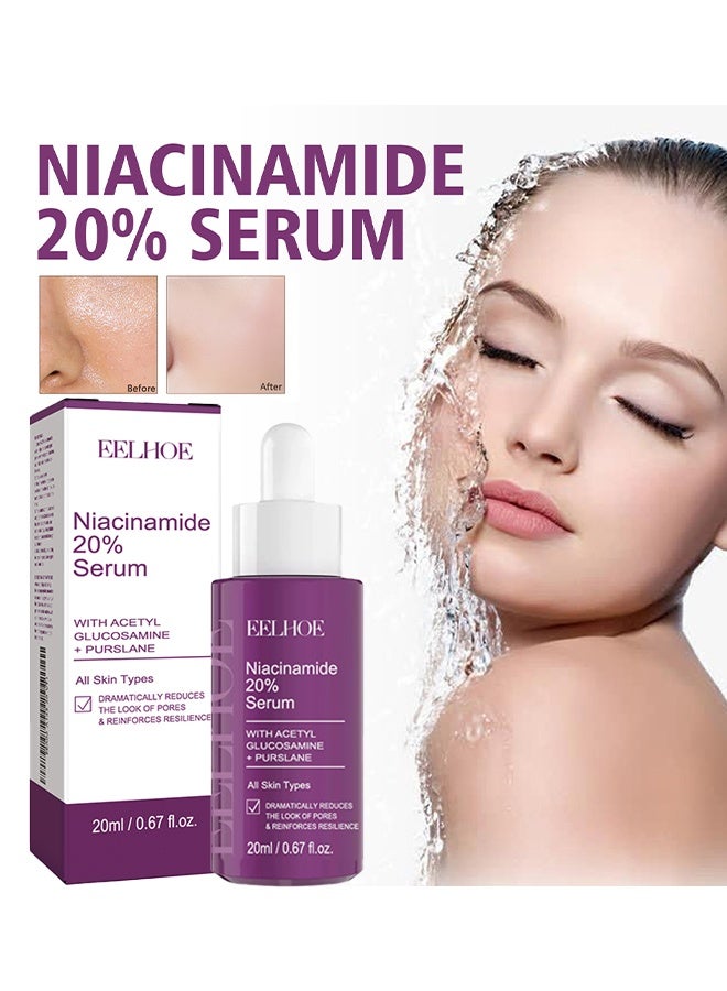 إيلهو نياسيناميد 20٪ سيروم ، سيروم مركز بفيتامين ب 3 ، مصل للوجه 20 مل مصل الوجه لإزالة البقع الداكنة ، خلاصة وجه خالية من العطور المضادة للشيخوخة لتغير اللون وتقليل المسام الكبيرة 20 مل - Image 1