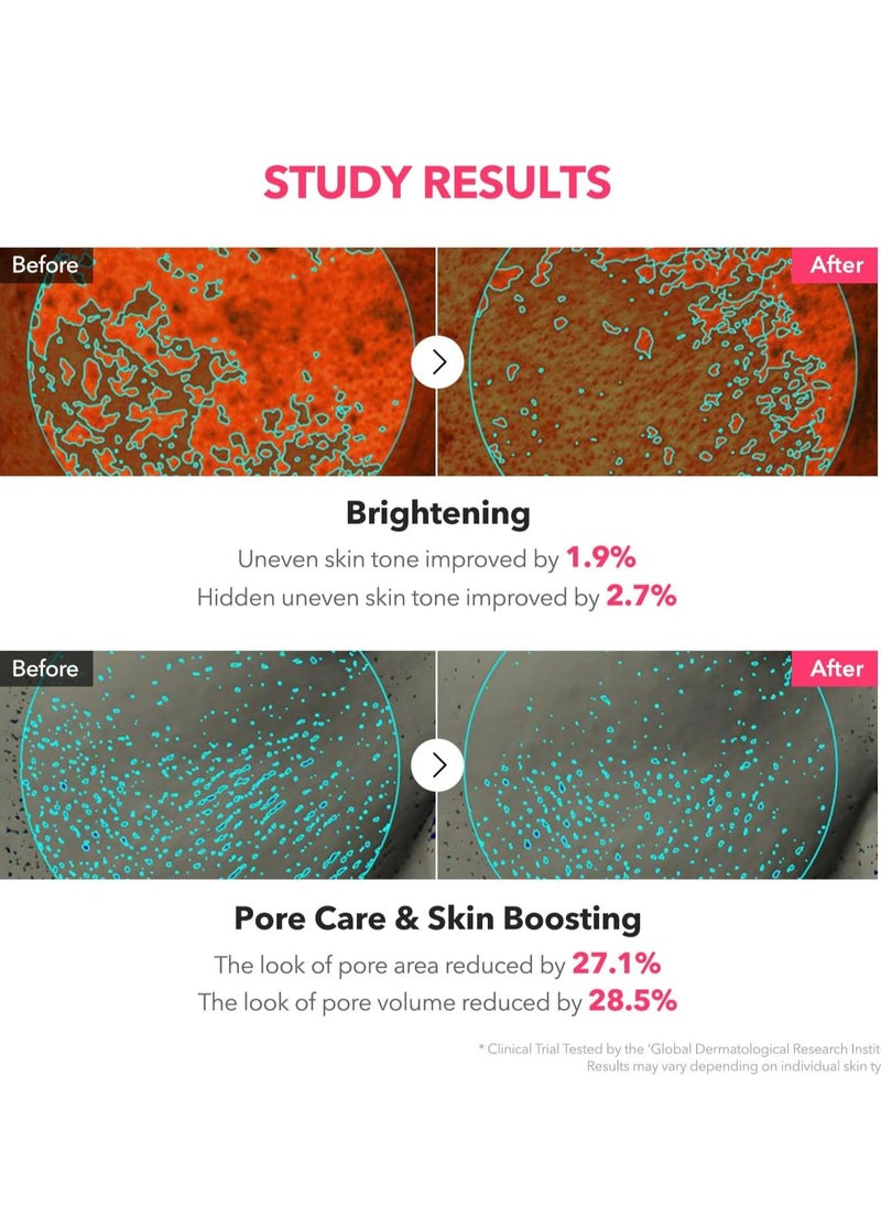 APRILSKIN TXA Niacinamide Toning Shot 99 Spicule Facial Serum｜Skin Booster Serum｜99% High-Purity Tranexamic Acid 3% + Niacinamide 5% for Uneven Skin Tone, Pore Care｜Korean Skin Care｜1.01 fl. oz.