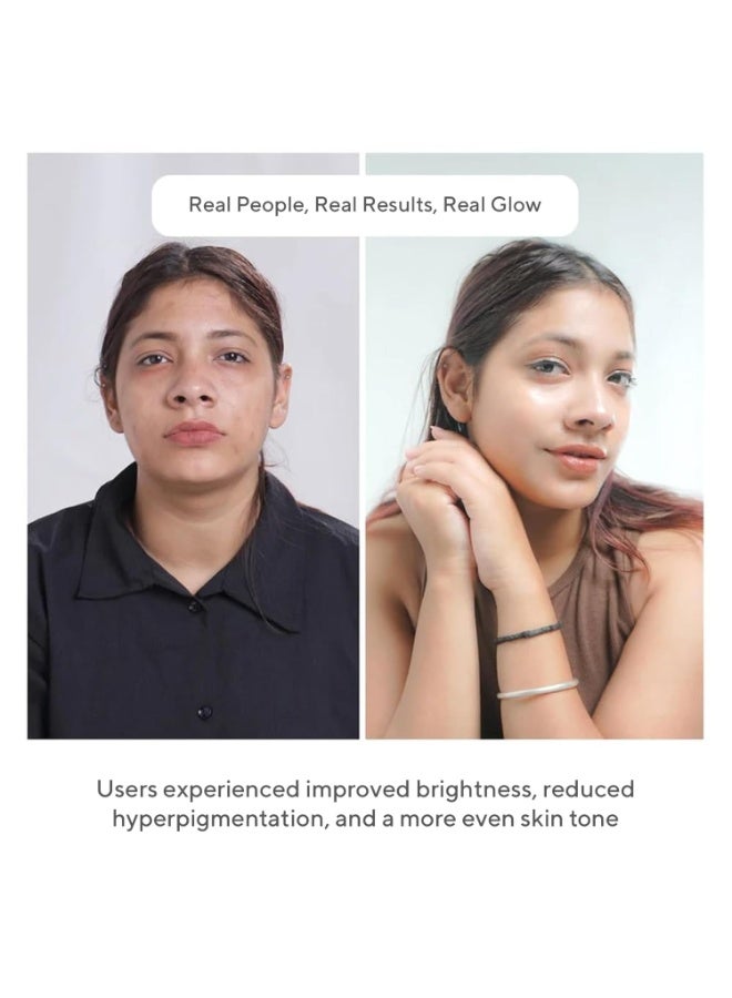 "كوز آي كيو" سيروم كوز-آي كيو ٢٣٪ فيتامين سي للوجه لبشرة متألقة، ٣٠ مل | تقنية جزيئية متطورة للعناية بالبشرة | تركيبة فائقة الثبات، غير مُهيّج، غير لزج | تركيبة مُشرقة ومرطبة للرجال والنساء - Image 5