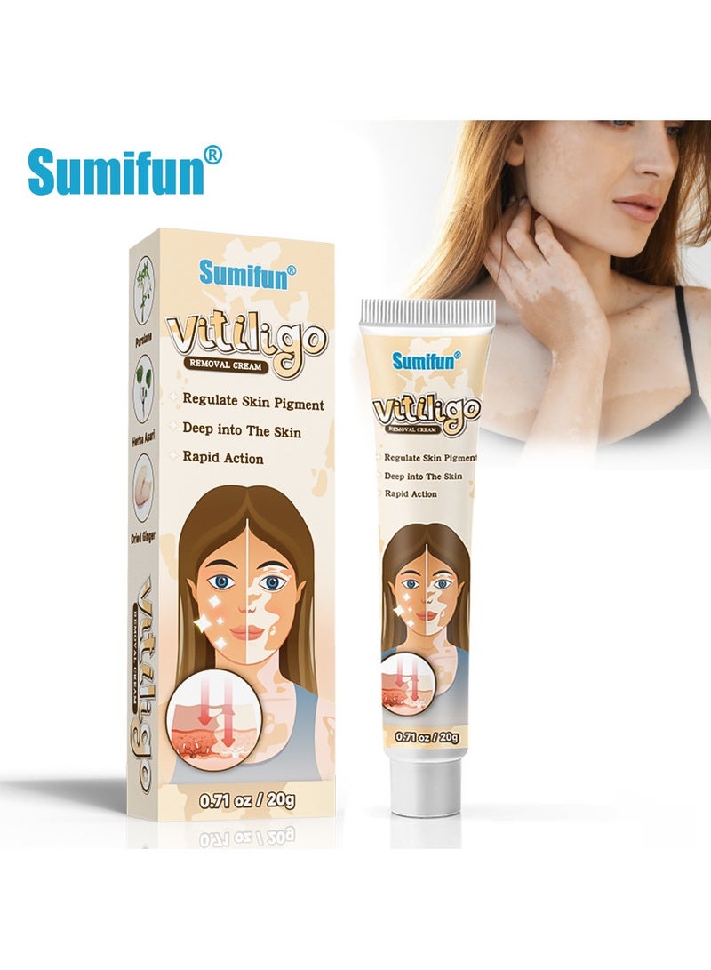 سوميفون عبوتين من مرهم البهاق، كريم للعناية بالبشرة، يقلل البقع البيضاء ويحسن التصبغ، 20 غرام*2 - Image 2