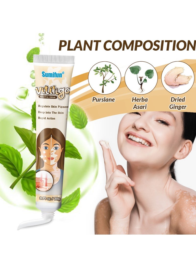 سوميفون عبوتين من مرهم البهاق، كريم للعناية بالبشرة، يقلل البقع البيضاء ويحسن التصبغ، 20 غرام*2 - Image 5