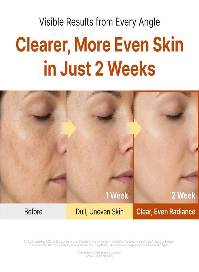 SUNGBOON EDITOR Glow Intensive Kojic Acid Ampoule, Radiance-Boosting Serum for Face with Kojic Acid, Turmeric & PHA, For Uneven Skin Tone & Dark Spot Care, Korean Skincare Serum, 1.35 fl oz - Image 3