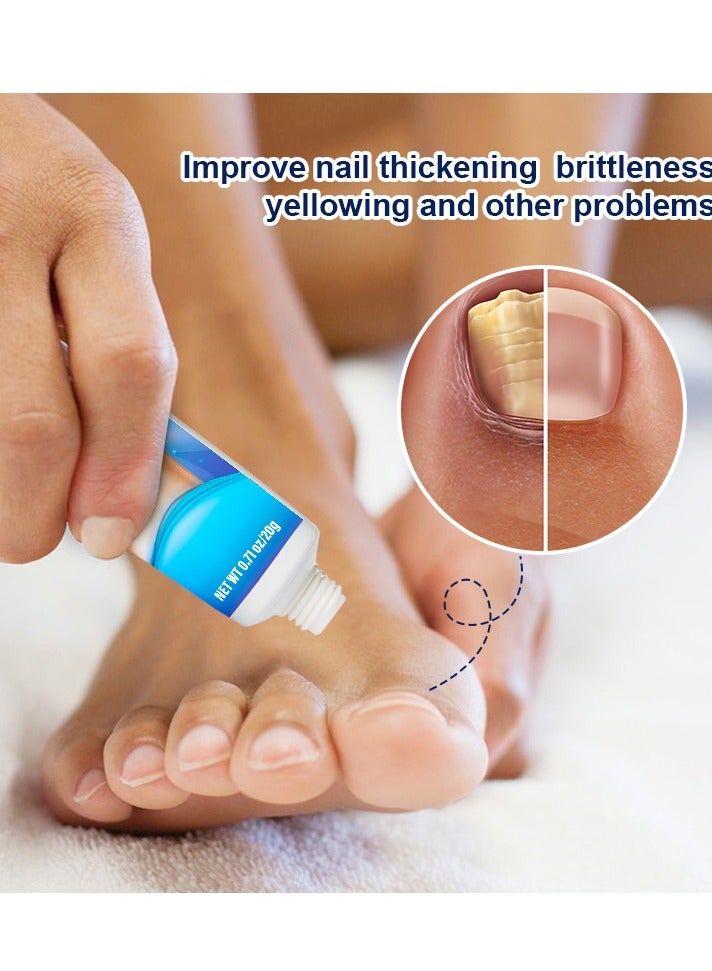 سوميفون كريم إصلاح العناية بفطريات الأظافر، محلول تجديد الأظافر لإصلاح الأظافر المتغيرة اللون والتالفة - Image 2