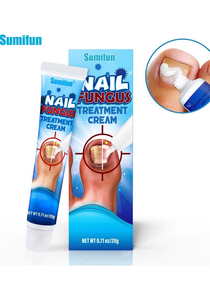 سوميفون كريم إصلاح العناية بفطريات الأظافر، محلول تجديد الأظافر لإصلاح الأظافر المتغيرة اللون والتالفة - Image 1