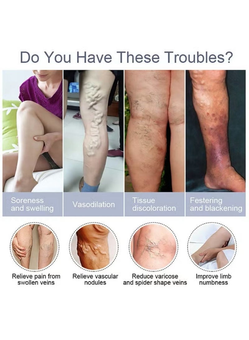 KanyeHB Varicose Veins Remove Cream 20g, Blood Circulation Vein Care Leg Cream, Vasculitis Phlebitis Foot Care Ointment, Pain Relief Therapy Firming Vein Lotion - Image 2