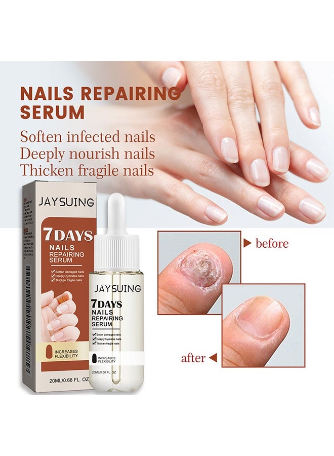 Jaysuing 7 Day Nail Repairing Serum – Nail Repair Oil for Damaged and Brittle Nails, Promotes Faster Nail Growth and Strengthens Nails, Transparent Treatment 20ml - Image 2