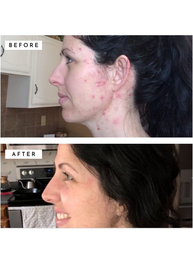 DIME Beauty Restorative Night Cream Moisturizer Restores Damaged And Dry Skin With Ceramides And Oligopeptide1 1 - Image 4