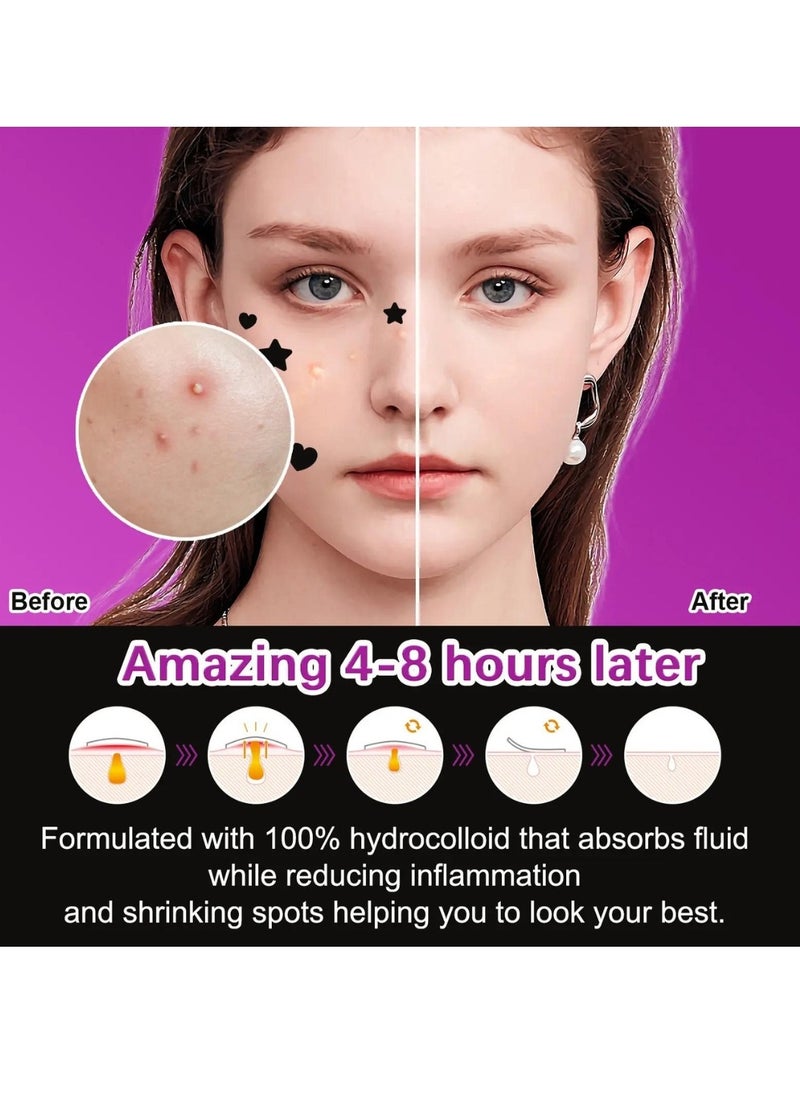Elaimei 144 Pcs Acne Pimple Patches Star and Heart Shape Acne Patch Treatment with Hydrocolloid and Tea Tree Oil Star Face Pimple Patches Spot Cover Stickers Acne Healing Miracle Patches  - Image 3