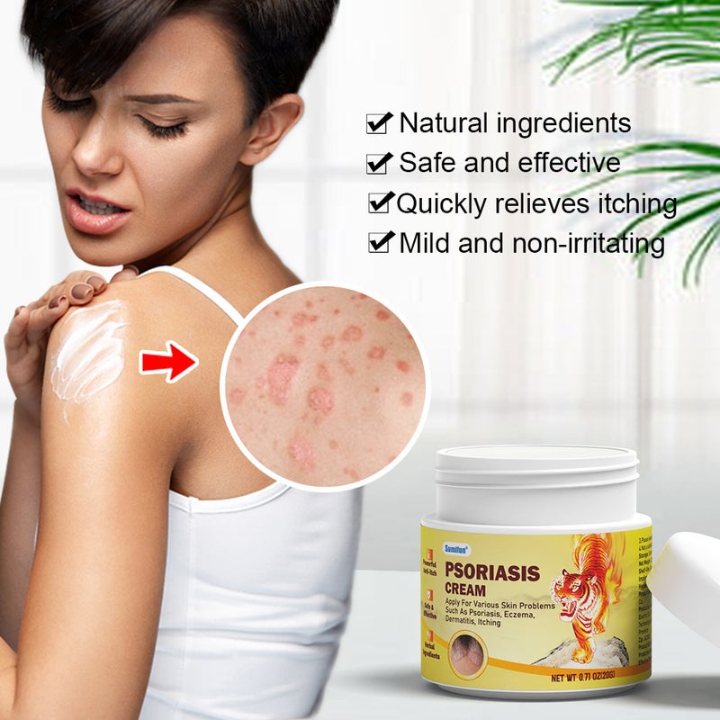 Sumifun Psoriasis Cream,Effective Treatment for Itchy Dry Skin,Supports Skin Repair for Scalp, Hands, and Feet - Image 4