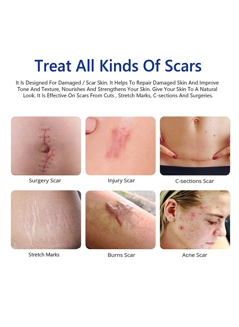 Elaimei - Scar Removal Cream for Surgical and Acne Scars Cuts Burns Natural Stretch Mark Removal Cream Helps with Old and New Scars Supports Skin Renewal Scar Cream for Women and Men All Skin Types 50ml - Image 1