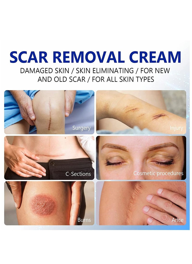 Elaimei - Scar Removal Cream for Surgical and Acne Scars Cuts Burns Natural Stretch Mark Removal Cream Helps with Old and New Scars Supports Skin Renewal Scar Cream for Women and Men All Skin Types 50ml - Image 1