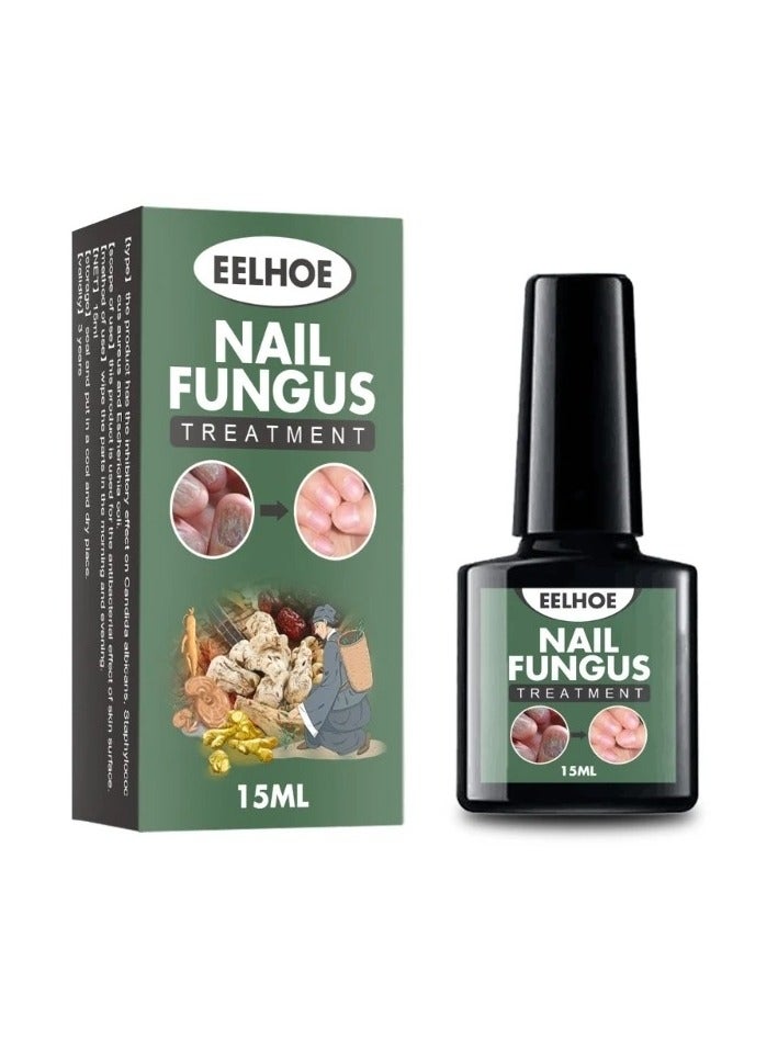 EELHOE Fungal Nail Liquid, Anti Fungal Nail Treatment Nail Care Solution, Anti-infection Fungus Removal Liquid, Safe Ginger-nail Fungal Treatment For Hand And Toe Nails - Image 1