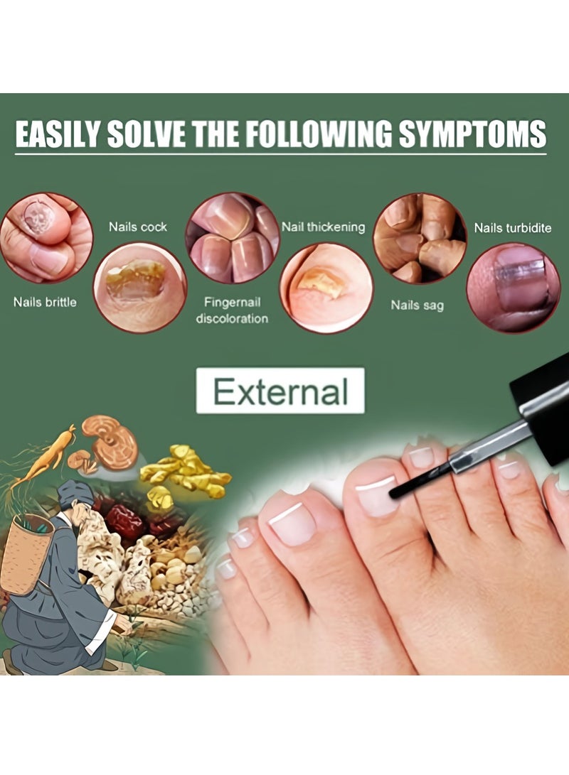 EELHOE Fungal Nail Liquid, Anti Fungal Nail Treatment Nail Care Solution, Anti-infection Fungus Removal Liquid, Safe Ginger-nail Fungal Treatment For Hand And Toe Nails - Image 2