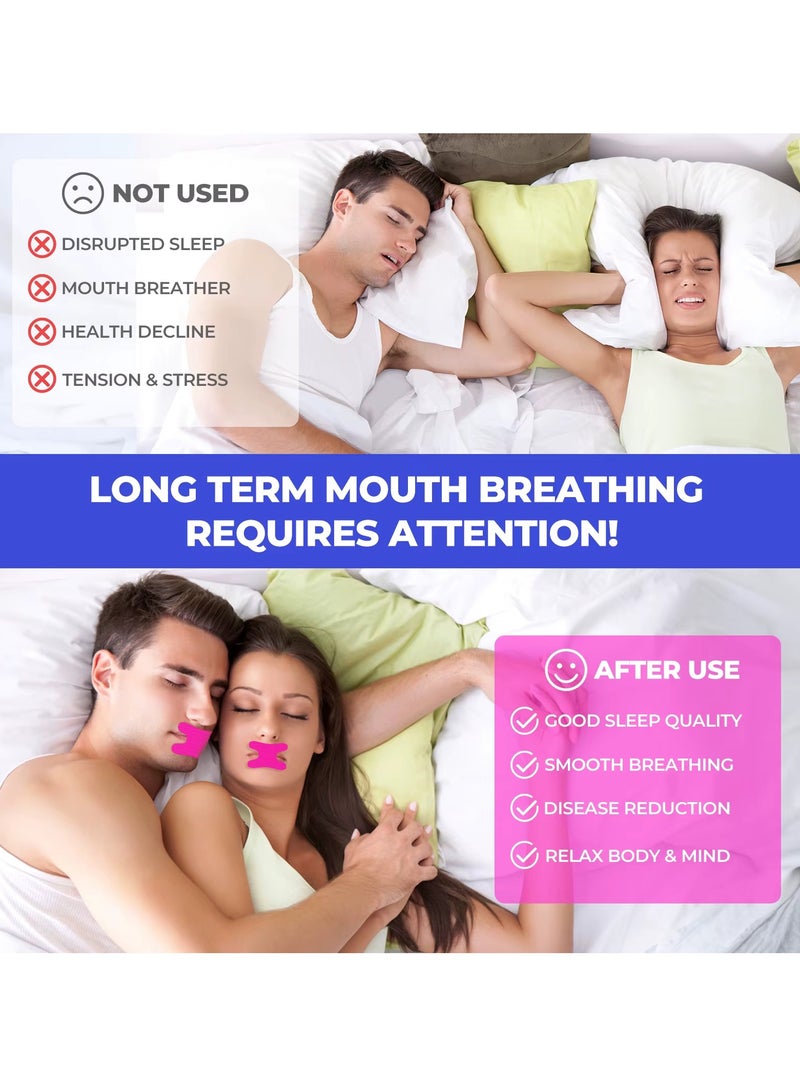Sefudun 50 قطعة شريط ميكروبور شريط فم النوم ناعم ومريح لاصق لطيف وآمن شريط فم للتنفس الأنفي مضاد للشخير تنفس أفضل شريط نوم خالي من الروائح شريط فم وردي - Image 2